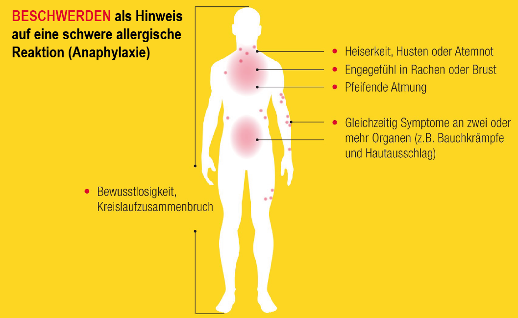 allergischer-schock