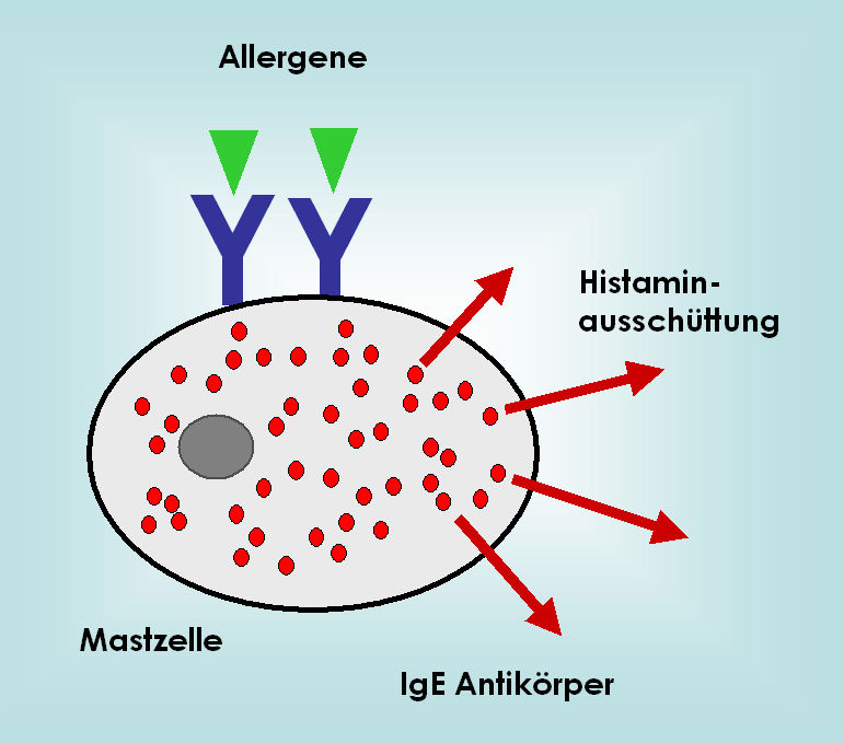 Prinzip der allergischen Sofortreaktion. Allergene binden an die IgE-Antikörperbindungsstellen, die in der Zellmembran der Mastzellen integriert sind.
